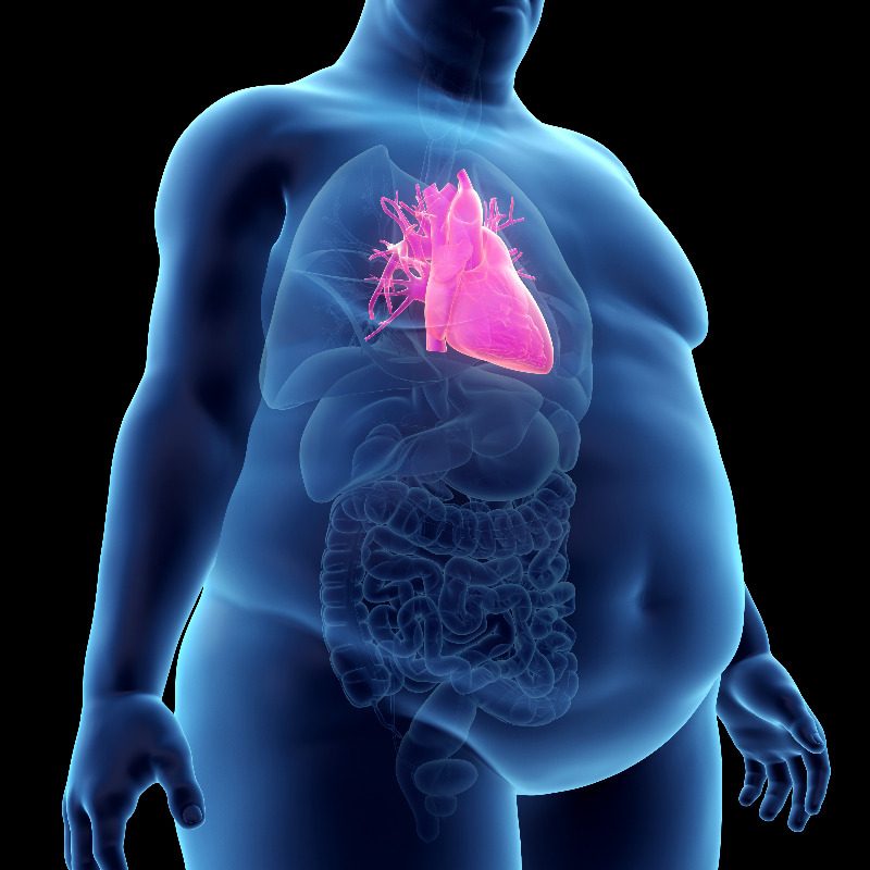 Congestive Heart Failure